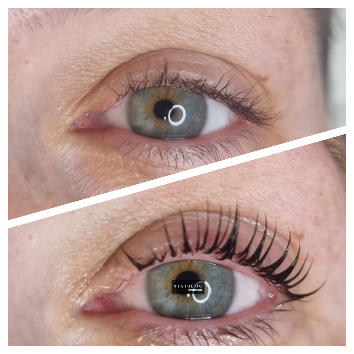 After treatment