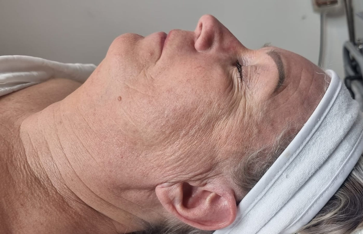 Before treatment