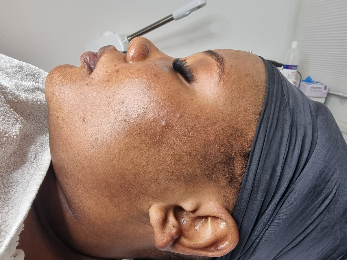 Before treatment