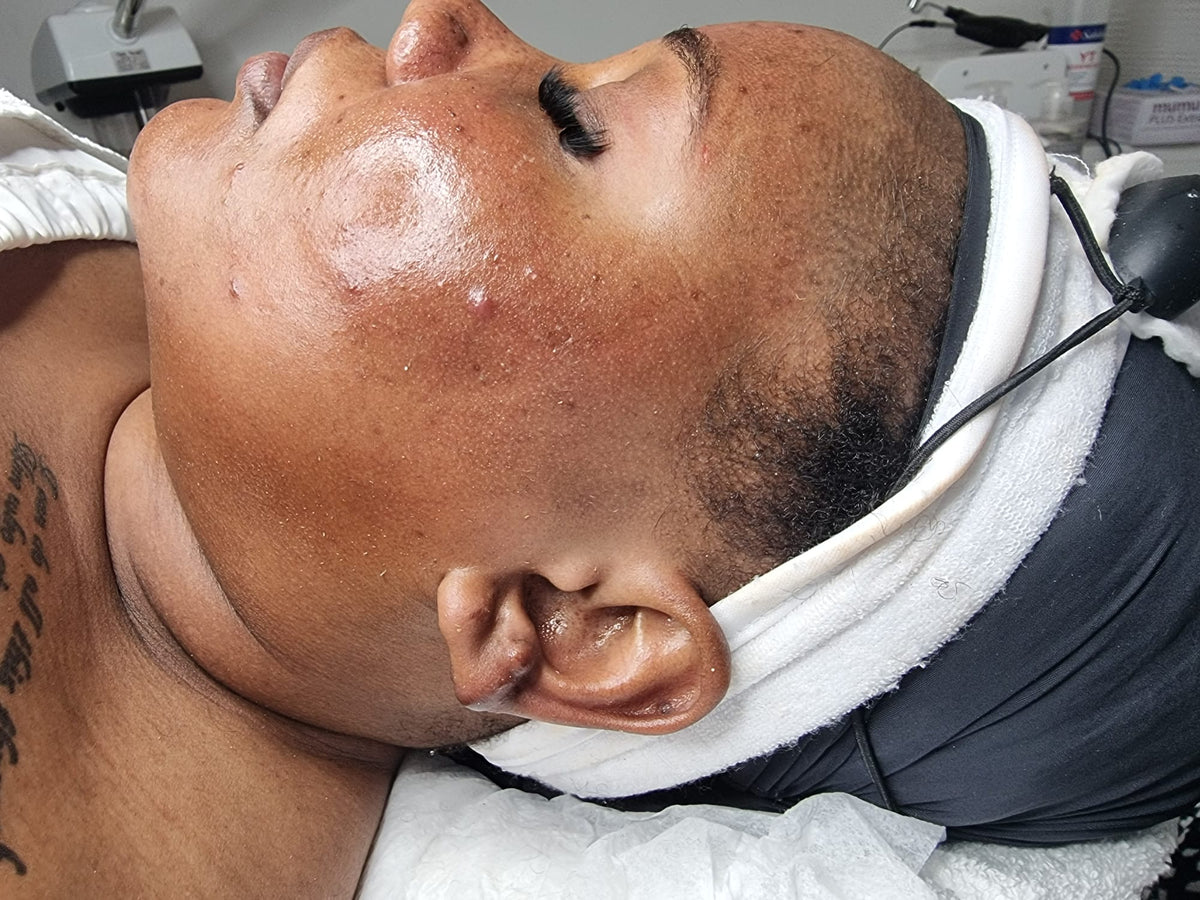 After treatment
