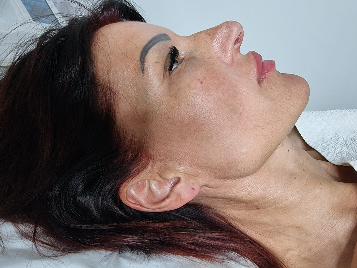 After treatment