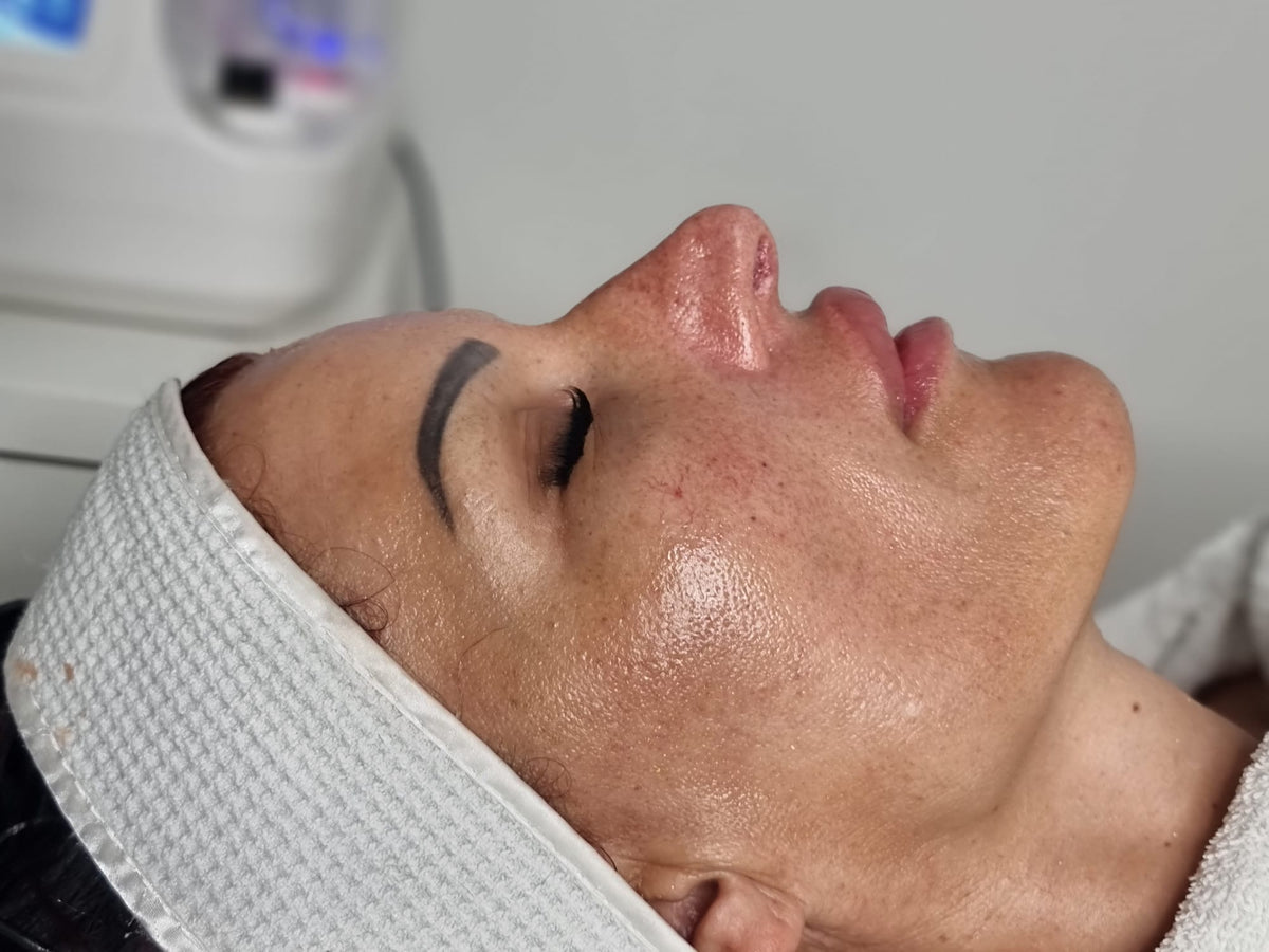 Before treatment