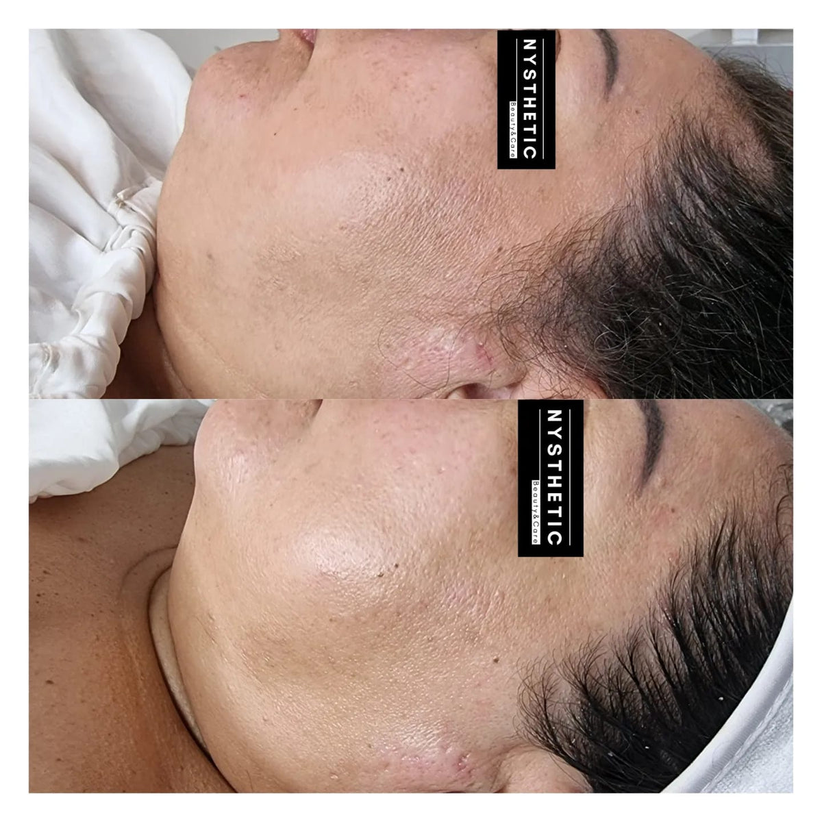 After treatment
