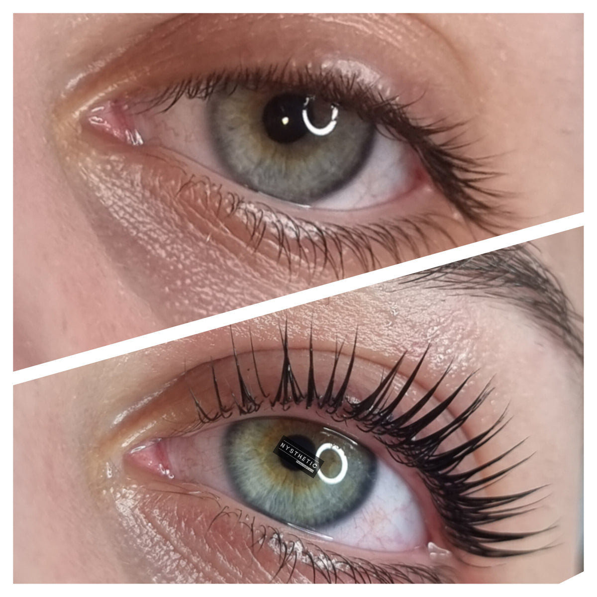 Before treatment