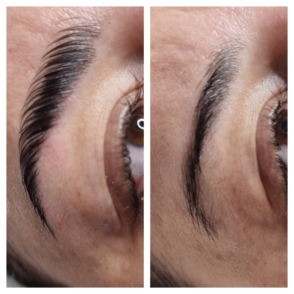 Before treatment