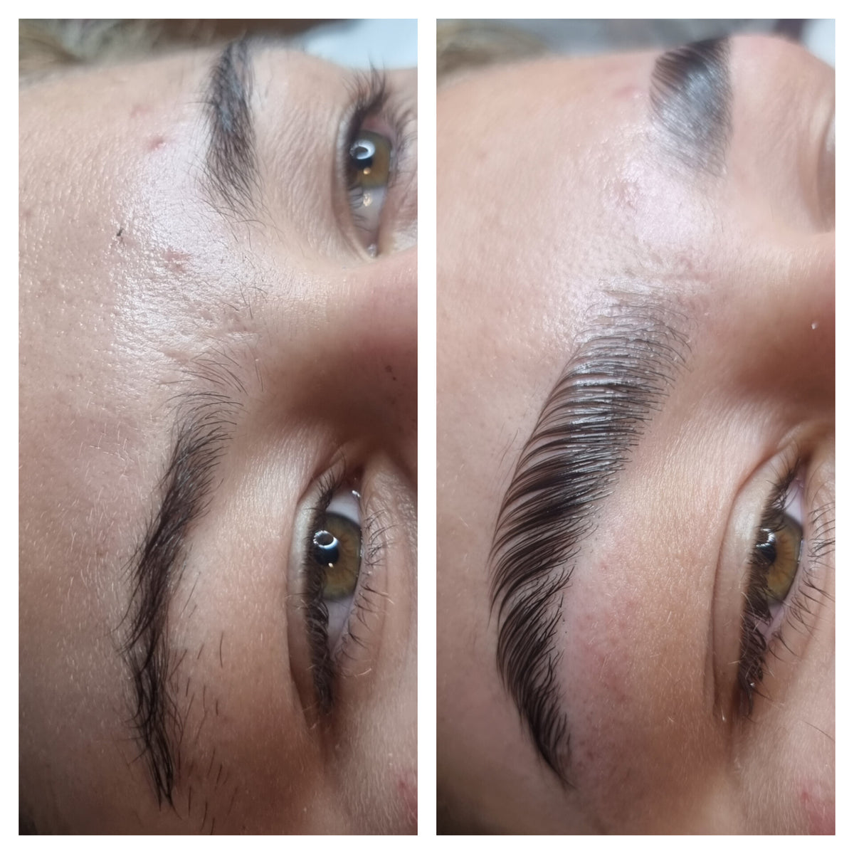 After treatment