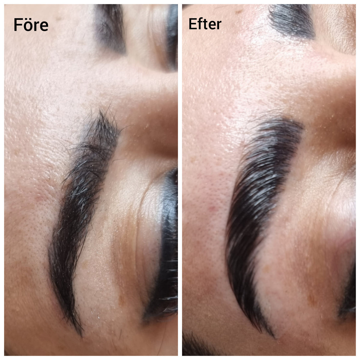 Before treatment