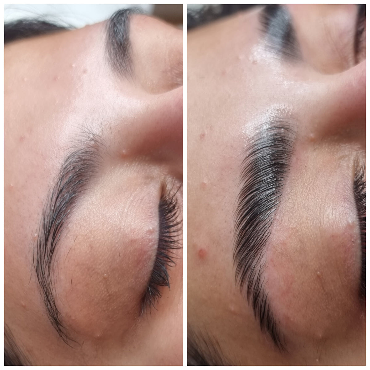 After treatment